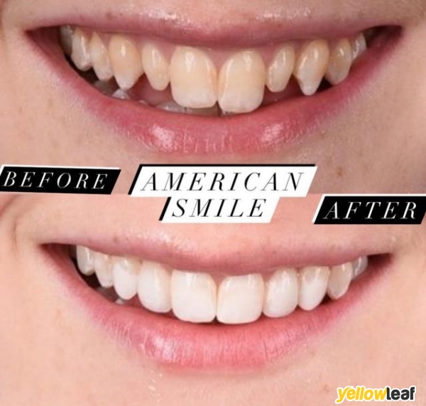 American Smile Dentists Chelsea